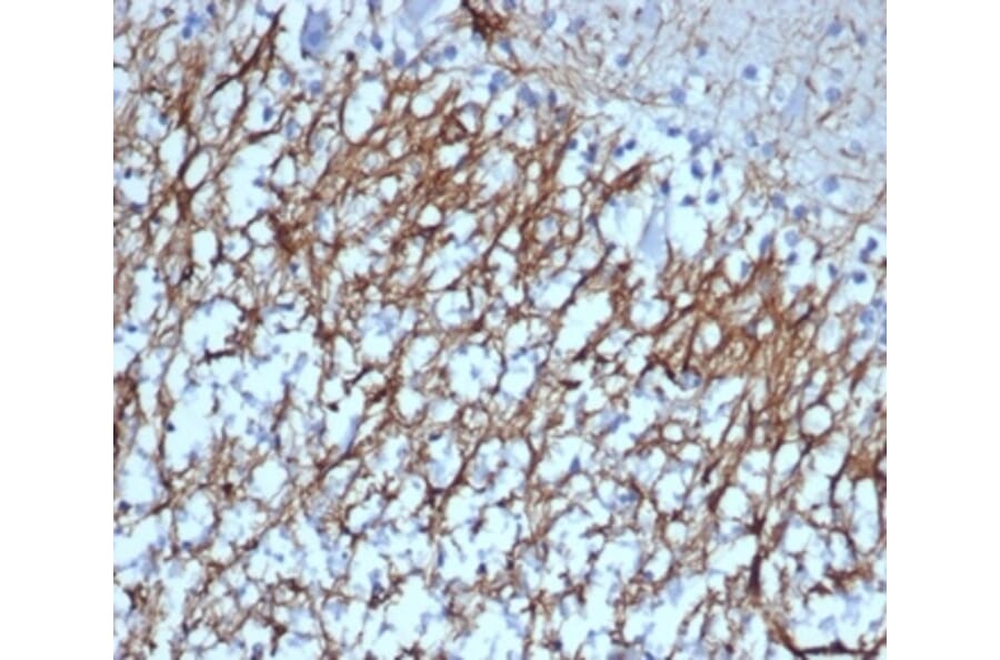 Immunohistochemistry - Anti-GFAP Antibody [GFAP/6879] (A277628) - Antibodies.com