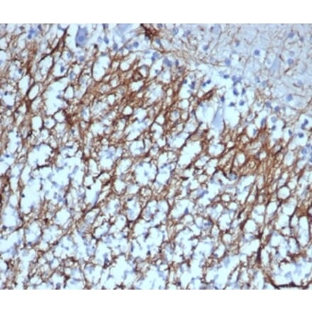 Immunohistochemistry - Anti-GFAP Antibody [GFAP/6879] (A277628) - Antibodies.com