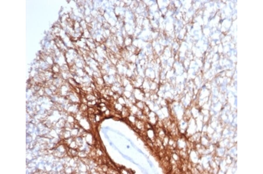 Immunohistochemistry - Anti-GFAP Antibody [GFAP/6879] (A277628) - Antibodies.com