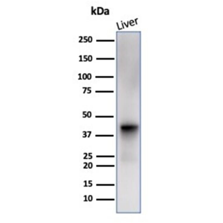 Western Blot - Anti-Glutamine Synthetase Antibody [GLUL/6600] (A277631) - Antibodies.com