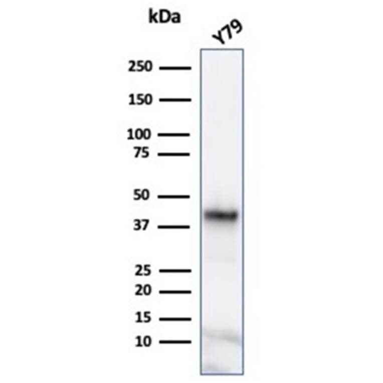 Western Blot - Anti-Glutamine Synthetase Antibody [GLUL/6600] (A277631) - Antibodies.com
