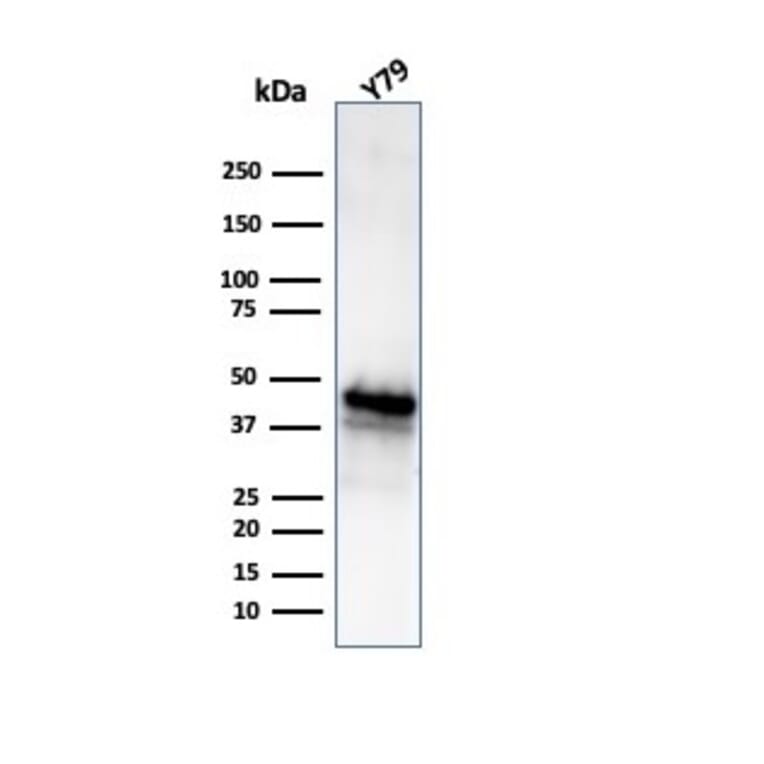 Western Blot - Anti-Glutamine Synthetase Antibody [GLUL/6604] (A277632) - Antibodies.com