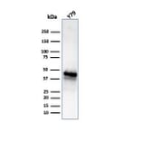 Western Blot - Anti-Glutamine Synthetase Antibody [GLUL/6604] (A277632) - Antibodies.com