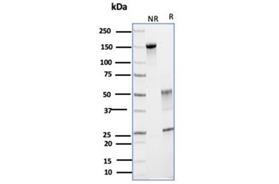 SDS-PAGE - Anti-Glutamine Synthetase Antibody [GLUL/6599] (A277633) - Antibodies.com