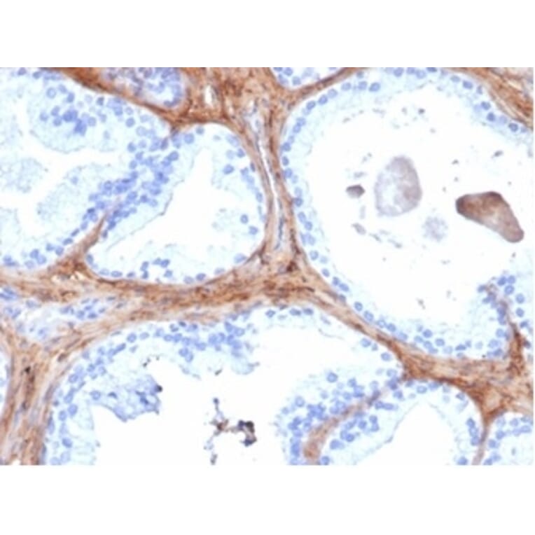 Immunohistochemistry - Anti-Decorin Antibody [DCN/6289] (A277635) - Antibodies.com