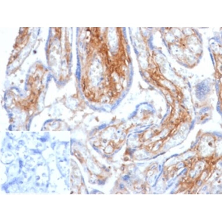 Immunohistochemistry - Anti-Decorin Antibody [DCN/6289] (A277635) - Antibodies.com