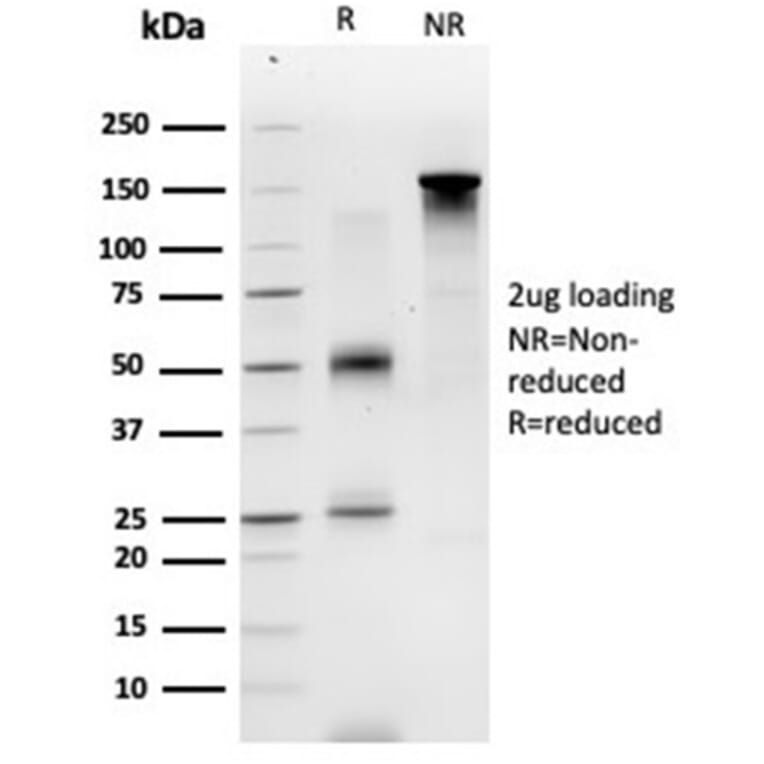 SDS-PAGE - Anti-GTF2A1 Antibody [PCRP-GTF2A1-1F2] (A277637) - Antibodies.com