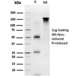 SDS-PAGE - Anti-GTF2A1 Antibody [PCRP-GTF2A1-1F2] (A277637) - Antibodies.com