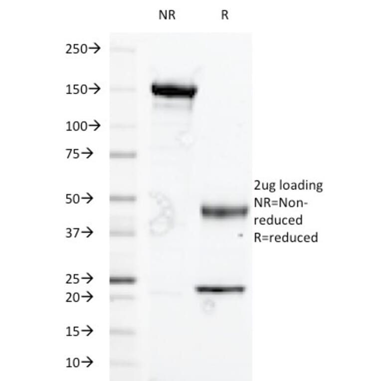 SDS-PAGE - Anti-Glycophorin A Antibody [A84-B/H2] (A277639) - Antibodies.com