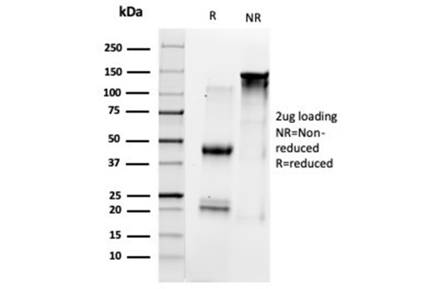 SDS-PAGE - Anti-HDAC1 Antibody [PCRP-HDAC1-1B7] (A277640) - Antibodies.com