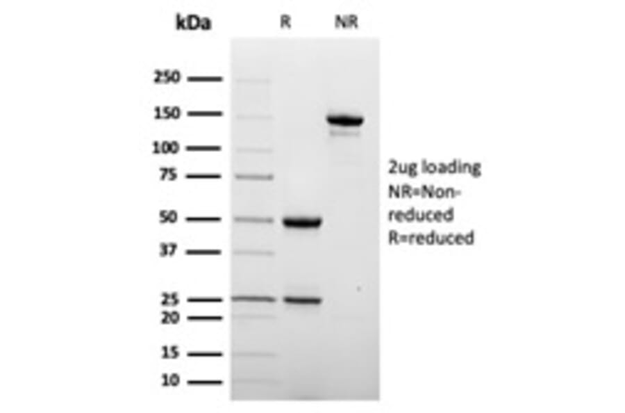 SDS-PAGE - Anti-DC-SIGN Antibody [C209/6774] (A277641) - Antibodies.com