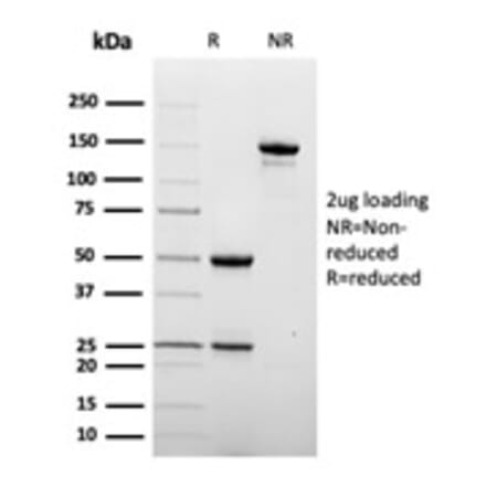 SDS-PAGE - Anti-DC-SIGN Antibody [C209/6774] (A277641) - Antibodies.com