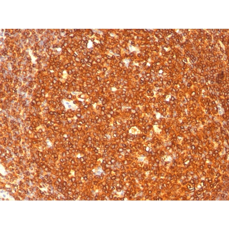 Immunohistochemistry - Anti-HLA DR Antibody [SPM289] (A277642) - Antibodies.com