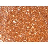 Immunohistochemistry - Anti-HLA DR Antibody [SPM289] (A277642) - Antibodies.com