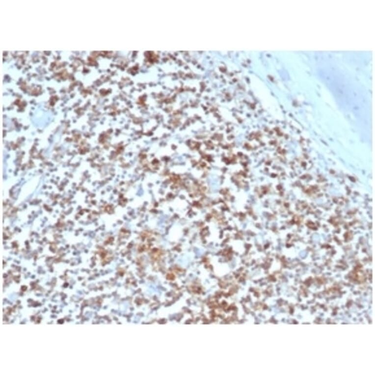 Immunohistochemistry - Anti-HLA G Antibody [HLAG/6686] (A277643) - Antibodies.com