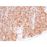 Immunohistochemistry - Anti-HLA G Antibody [HLAG/6686] (A277643) - Antibodies.com