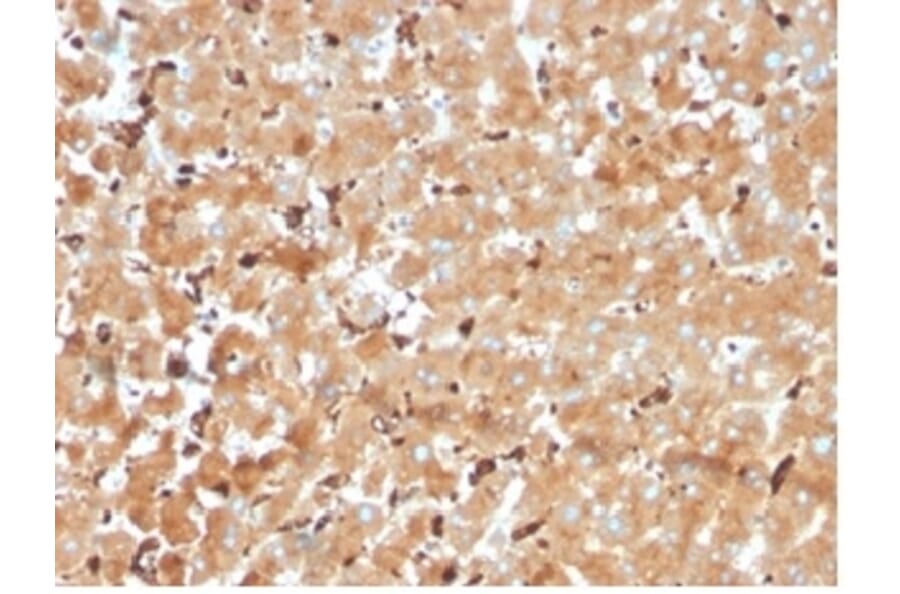 Immunohistochemistry - Anti-Haptoglobin Antibody [HP/3840] (A277645) - Antibodies.com