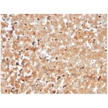 Immunohistochemistry - Anti-Haptoglobin Antibody [HP/3840] (A277645) - Antibodies.com