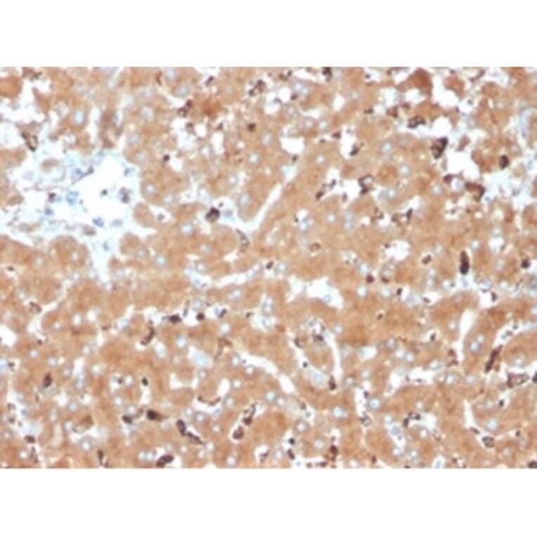 Immunohistochemistry - Anti-Haptoglobin Antibody [HP/3835] (A277646) - Antibodies.com