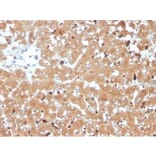 Immunohistochemistry - Anti-Haptoglobin Antibody [HP/3835] (A277646) - Antibodies.com