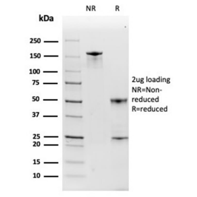 SDS-PAGE - Anti-Haptoglobin Antibody [HP/3835] (A277646) - Antibodies.com