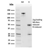 SDS-PAGE - Anti-Haptoglobin Antibody [HP/3835] (A277646) - Antibodies.com