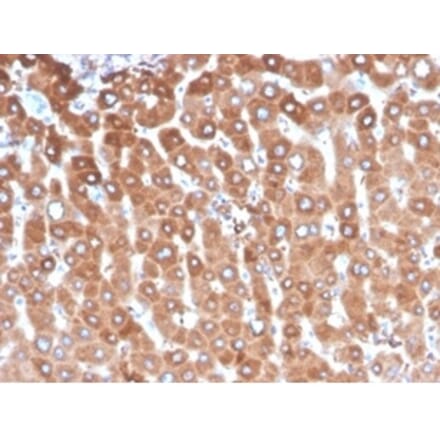 Immunohistochemistry - Anti-Haptoglobin Antibody [HP/3837] (A277647) - Antibodies.com