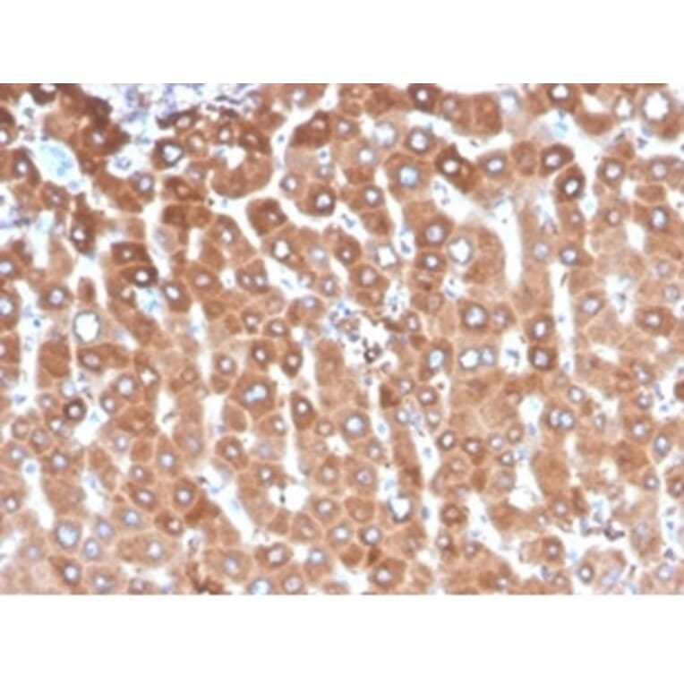 Immunohistochemistry - Anti-Haptoglobin Antibody [HP/3837] (A277647) - Antibodies.com