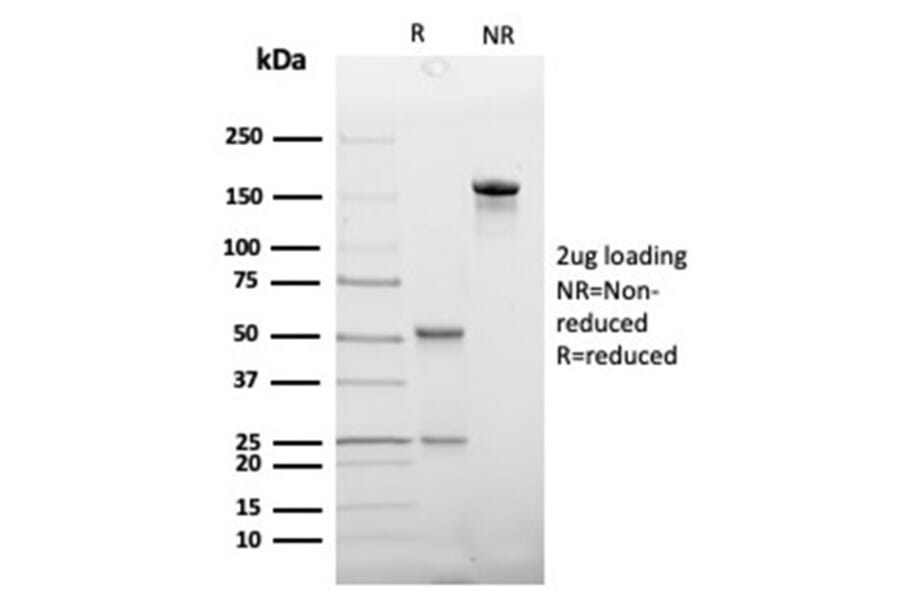 SDS-PAGE - Anti-Haptoglobin Antibody [HP/3837] (A277647) - Antibodies.com