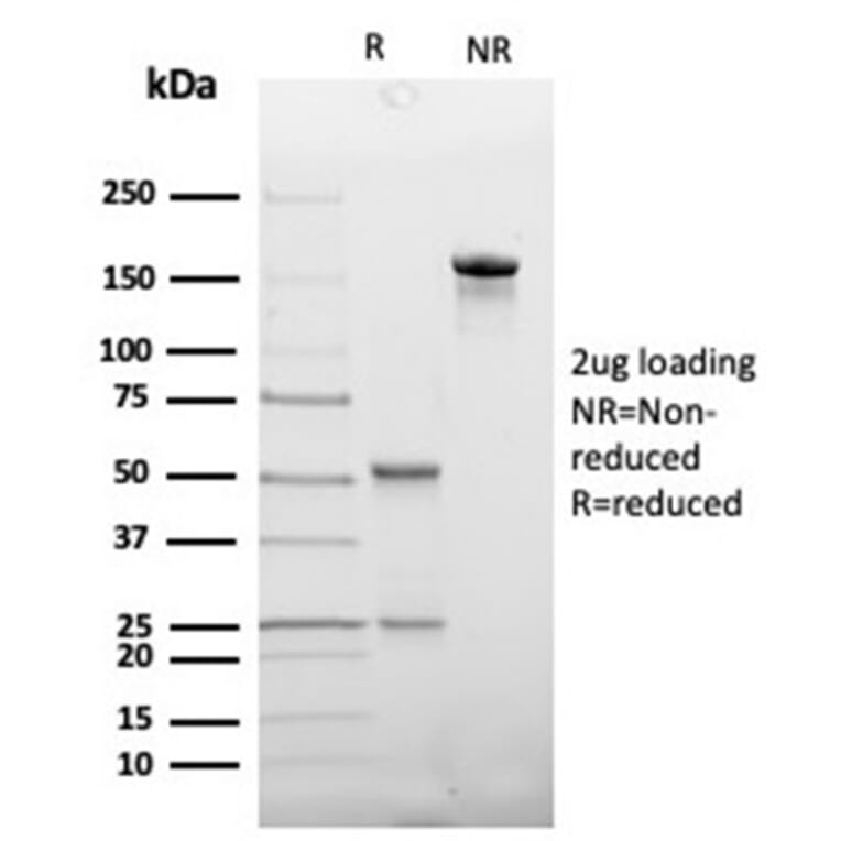 SDS-PAGE - Anti-Haptoglobin Antibody [HP/3837] (A277647) - Antibodies.com