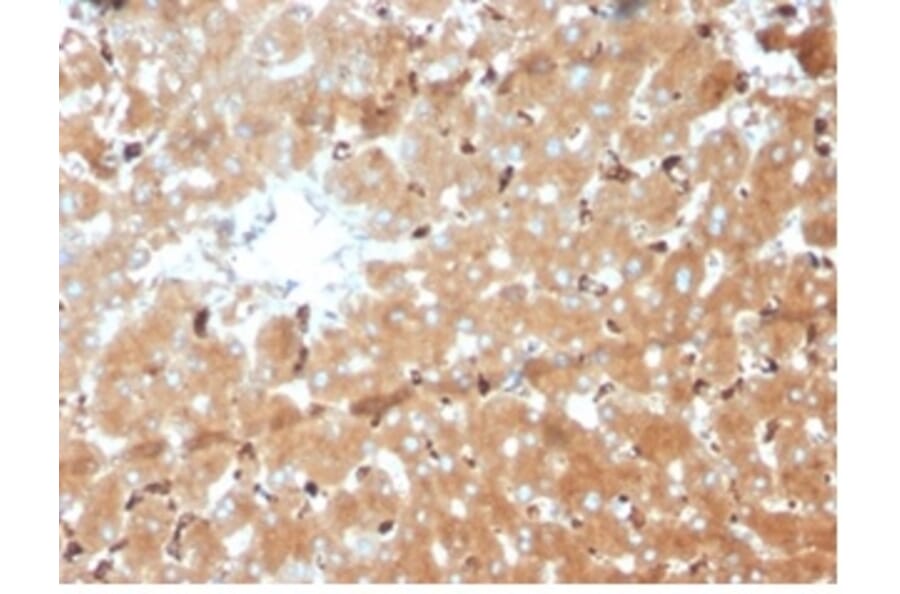 Immunohistochemistry - Anti-Haptoglobin Antibody [HP/3839] (A277648) - Antibodies.com