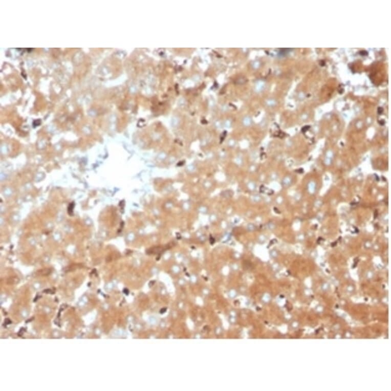 Immunohistochemistry - Anti-Haptoglobin Antibody [HP/3839] (A277648) - Antibodies.com