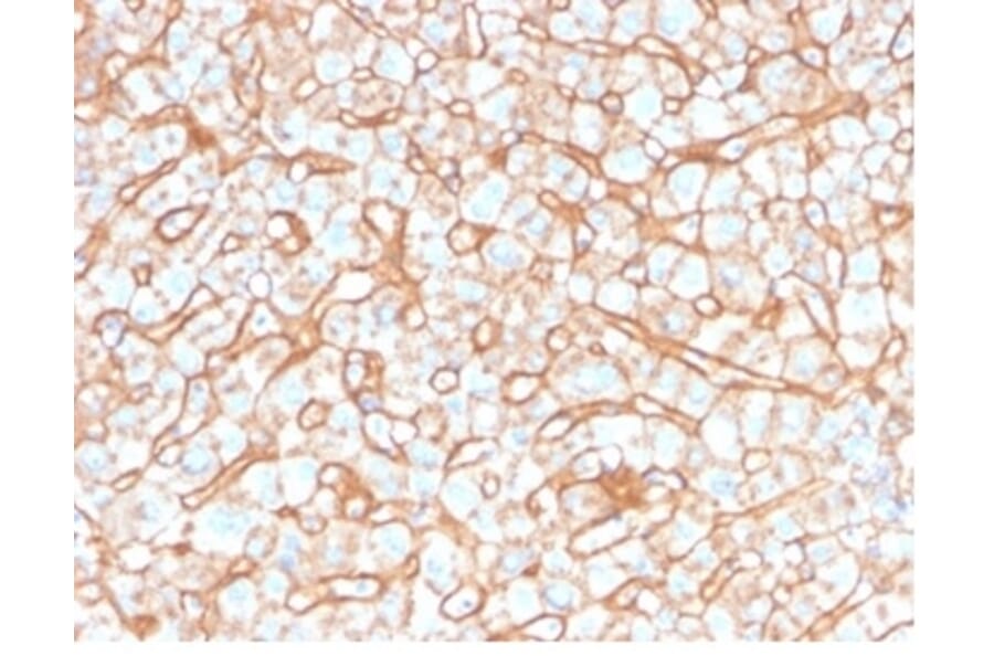 Immunohistochemistry - Anti-Apolipoprotein B Antibody [APOB/4332] (A277649) - Antibodies.com