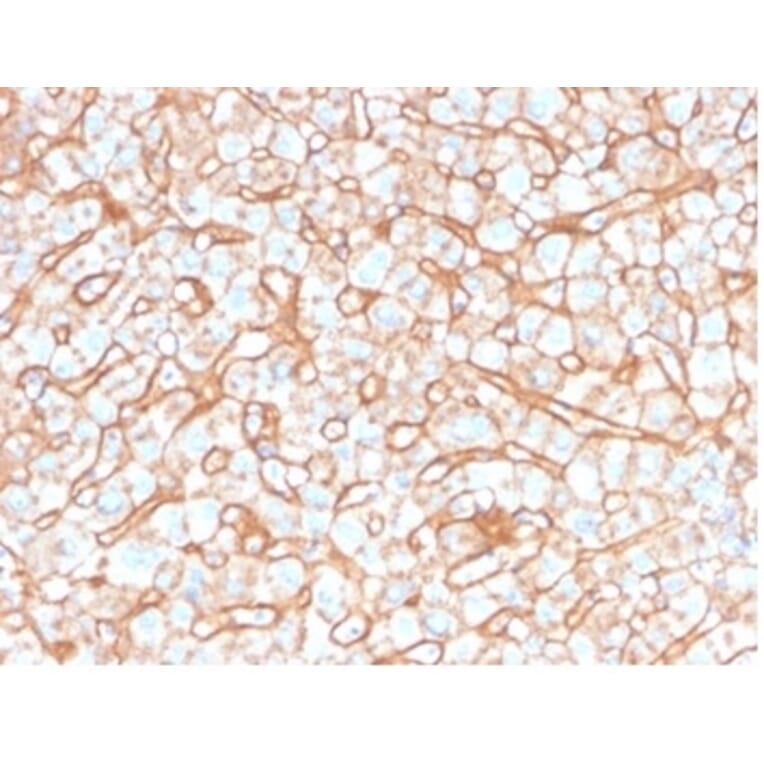 Immunohistochemistry - Anti-Apolipoprotein B Antibody [APOB/4332] (A277649) - Antibodies.com