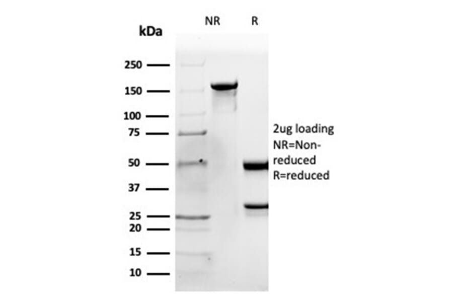 SDS-PAGE - Anti-Apolipoprotein B Antibody [APOB/4335] (A277650) - Antibodies.com