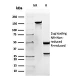 SDS-PAGE - Anti-Apolipoprotein B Antibody [APOB/4335] (A277650) - Antibodies.com
