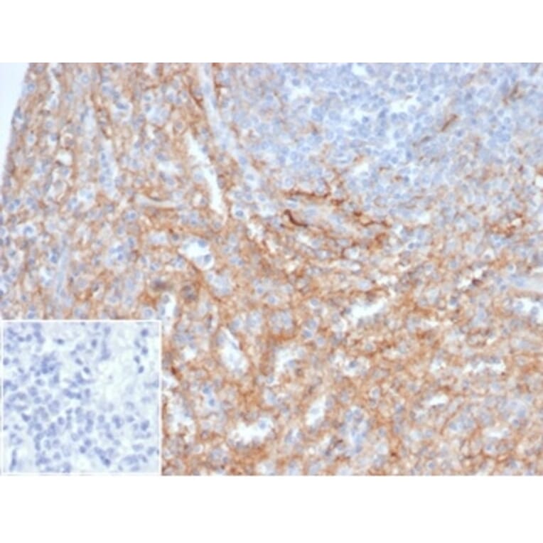 Immunohistochemistry - Anti-ICAM1 Antibody [ICAM1/6917] (A277651) - Antibodies.com