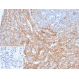 Immunohistochemistry - Anti-ICAM1 Antibody [ICAM1/6917] (A277651) - Antibodies.com