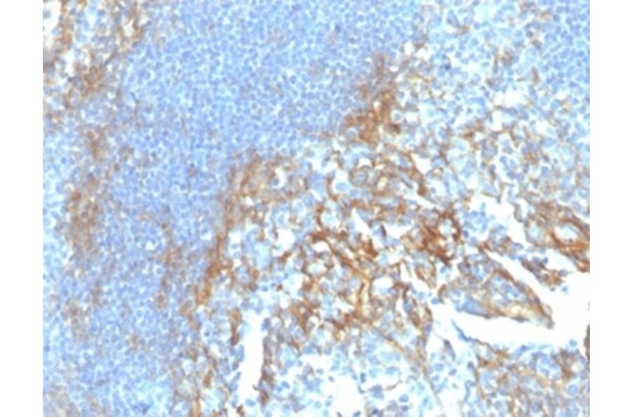 Immunohistochemistry - Anti-ICAM1 Antibody [ICAM1/6917] (A277651) - Antibodies.com