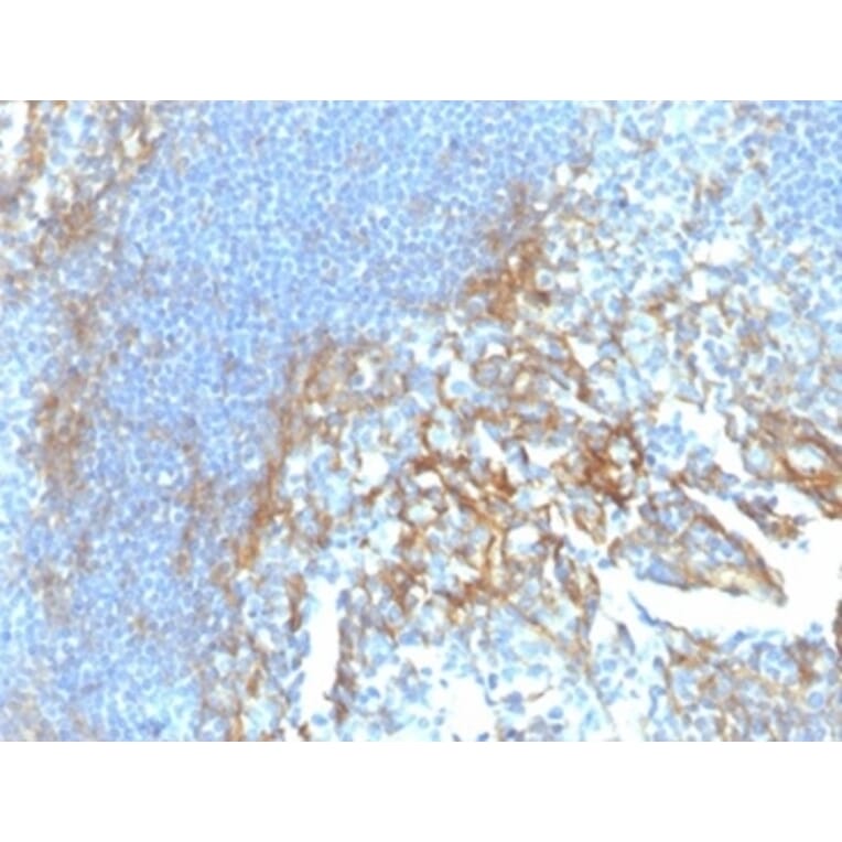 Immunohistochemistry - Anti-ICAM1 Antibody [ICAM1/6917] (A277651) - Antibodies.com