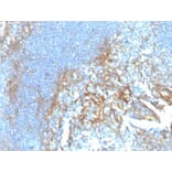 Immunohistochemistry - Anti-ICAM1 Antibody [ICAM1/6917] (A277651) - Antibodies.com