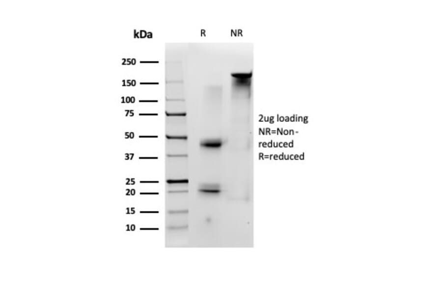 SDS-PAGE - Anti-ID1 Antibody [PCRP-ID1-2F11] (A277652) - Antibodies.com