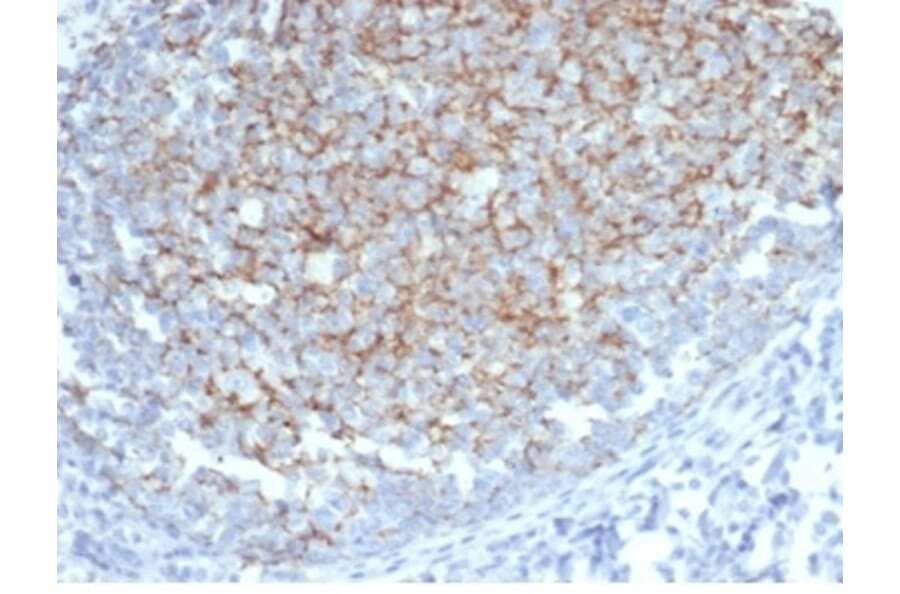 Immunohistochemistry - Anti-Interferon alpha 1 Antibody [IFNA/6689] (A277653) - Antibodies.com