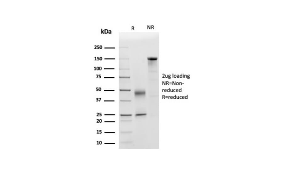 SDS-PAGE - Anti-Apolipoprotein D Antibody [APOD/3415] (A277655) - Antibodies.com