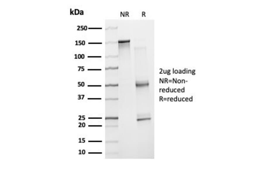 SDS-PAGE - Anti-ZNF81 Antibody [PCRP-ZNF81-2C7] (A277656) - Antibodies.com