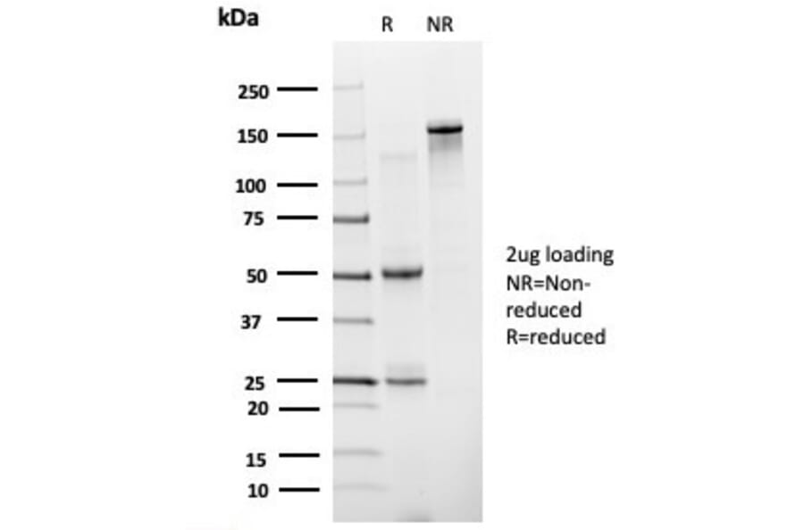 SDS-PAGE - Anti-ZNF81 Antibody [PCRP-ZNF81-2G2] (A277657) - Antibodies.com