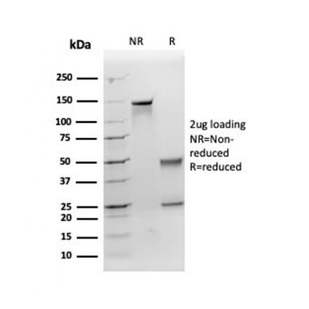 SDS-PAGE - Anti-Apolipoprotein E Antibody [APOE/3671] (A277658) - Antibodies.com