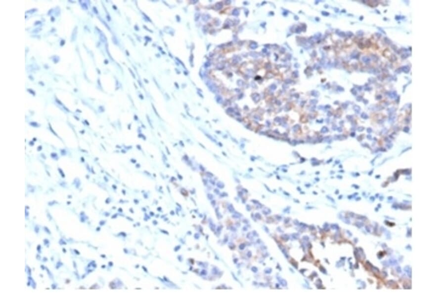 Immunohistochemistry - Anti-IGF1 Receptor Antibody [IGF1R/4667] (A277659) - Antibodies.com