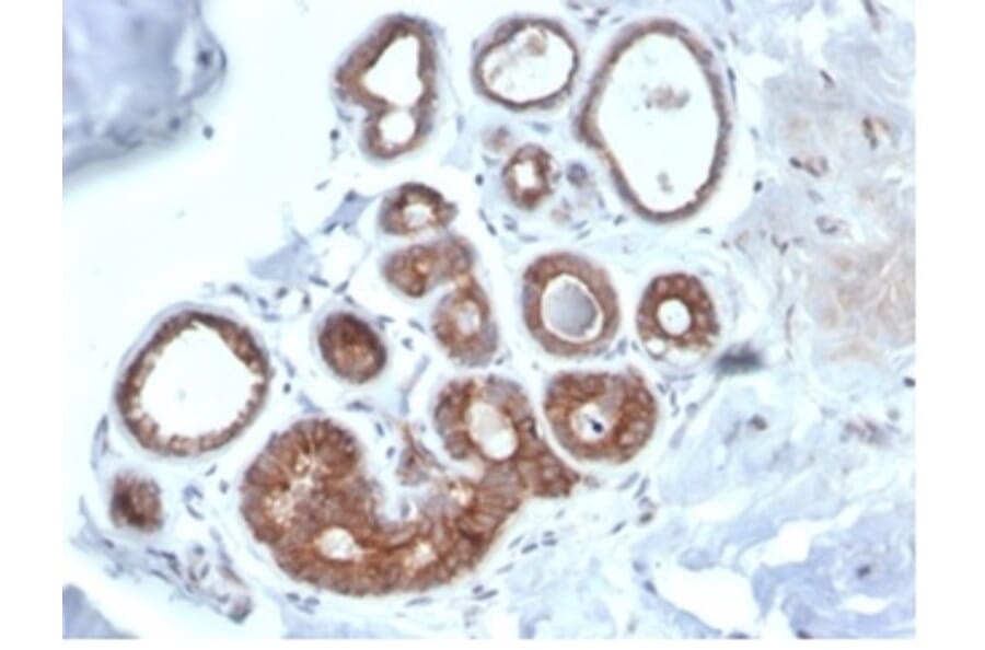 Immunohistochemistry - Anti-IGF1 Receptor Antibody [IGF1R/4667] (A277659) - Antibodies.com