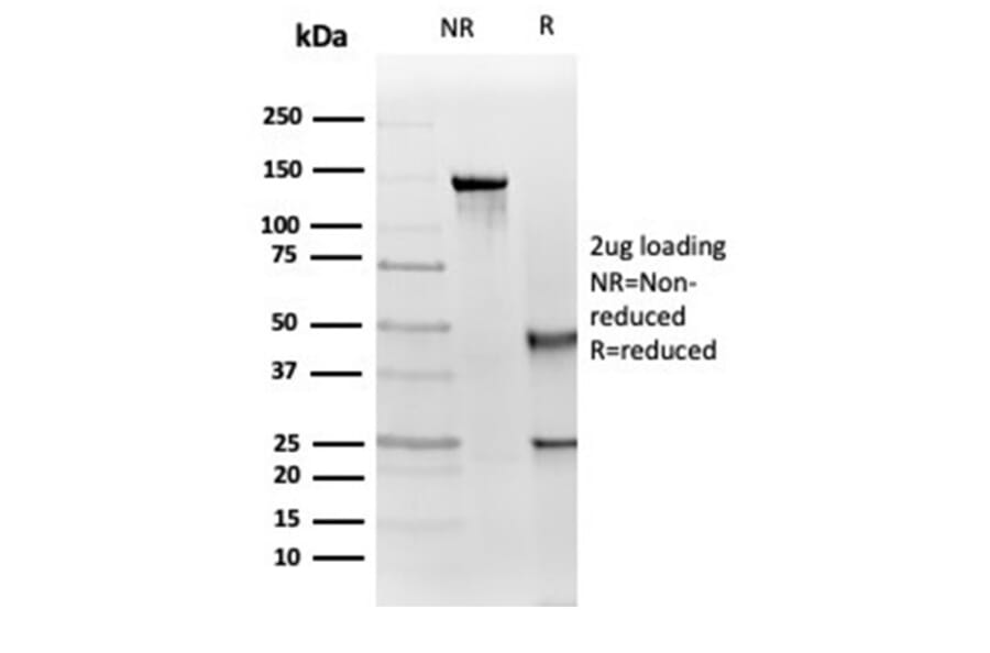 Immunohistochemistry - Anti-IGF1 Receptor Antibody [IGF1R/4667] (A277659) - Antibodies.com